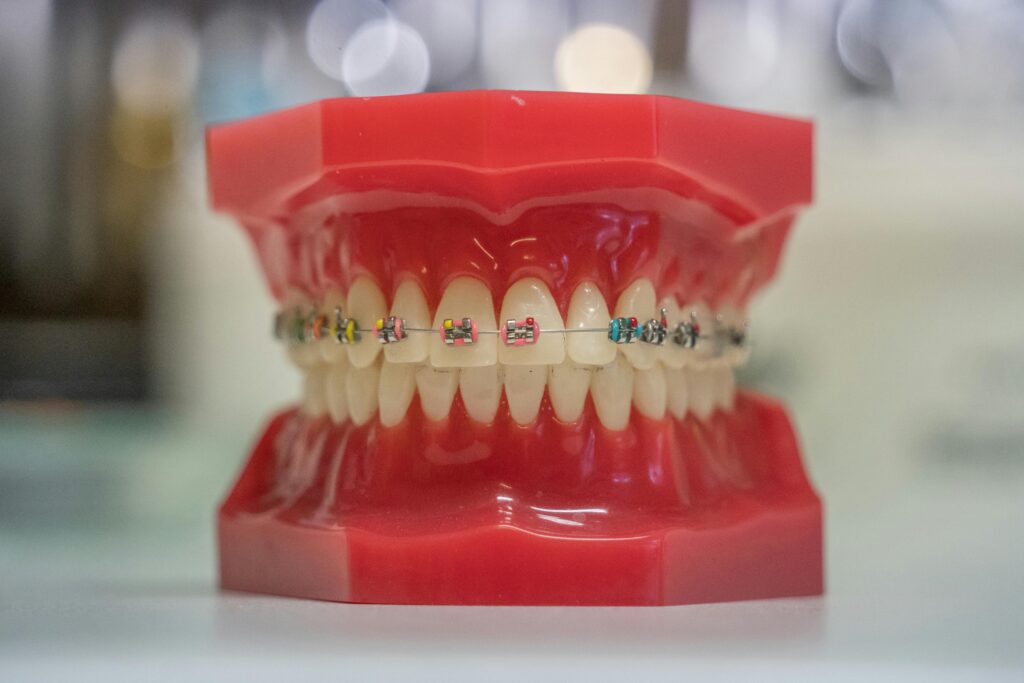 pexels photo 19328507 19328507 Model of human teeth with colorful braces, showcasing dental care and orthodontics.